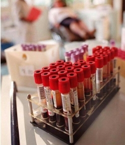 Cresce in Toscana il fabbisogno di donazioni di sangue