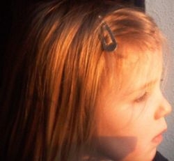 Sindrome di Rett, 230mila euro dal Ministero della Salute per la ricerca senese