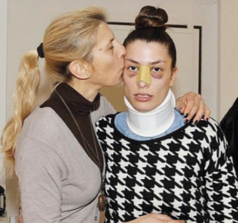 Il Tirreno Grosseto: Ragazza grossetana picchiata dall’ex fidanzato, l’intervento dello …