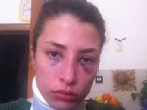 Jessica e le botte dell’ex. Lo psicologo: «L’uomo non accetta la separazione da chi pensa di possedere»