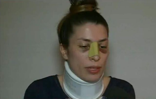 Picchiata dall’ex,  riceve telefonata da Boldrini: «Complimenti per il suo coraggio»