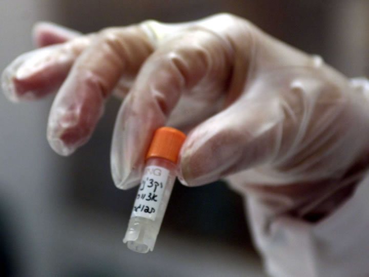 L’Esercito studia farmaco anti-ebola, a Firenze test sullo “stop shock”