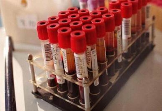 Novità Toscana. Emoderivati, arriva l’etichetta etica su farmaci prodotti con plasma da donazioni volontarie