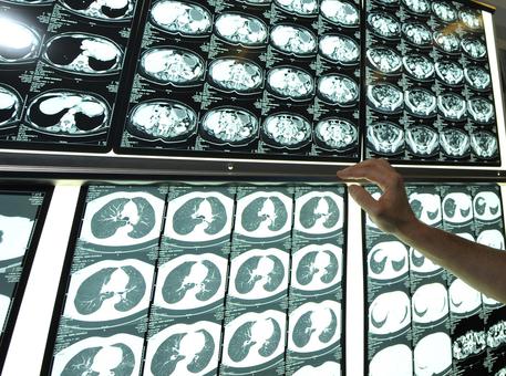 Stop superticket. Toscana, dall’1 aprile non si paga più il contributo da 10 euro per diagnostica immagini