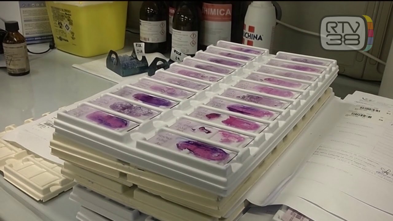 Coronavirus. Massima allerta in Toscana contro le varianti del virus