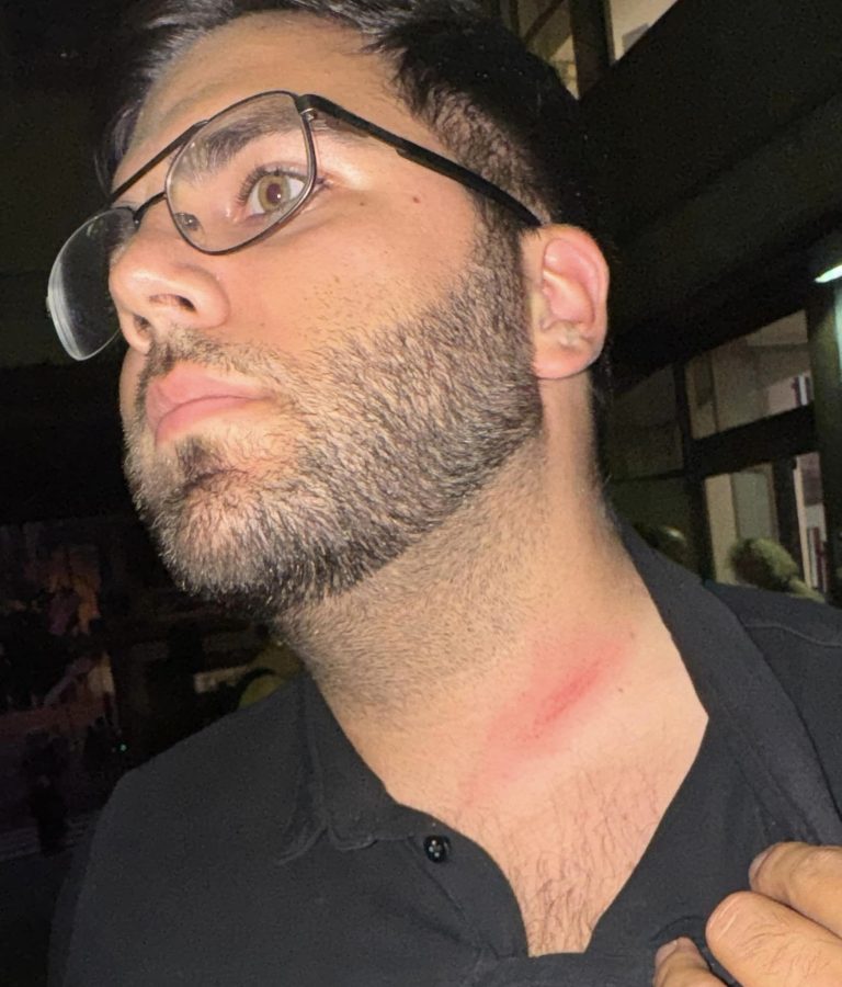 Massa, mani sul collo al consigliere Frugoli: Lega chiede dimissioni di Alberti (Pd)