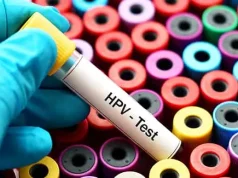 Malattie sessualmente trasmissibili in aumento: contromisure affidate alla sensibilizzazione dei cittadini